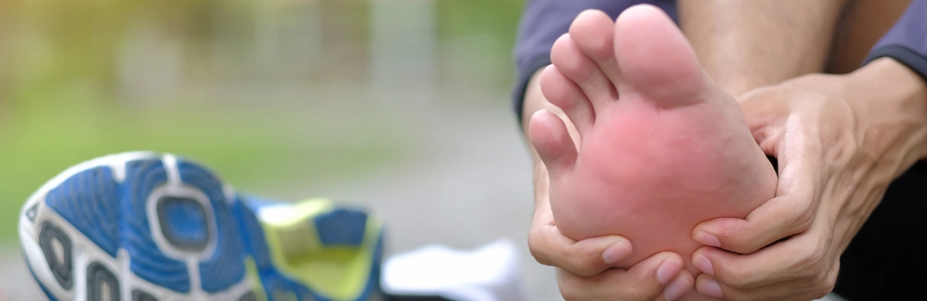 best podiatrist in chennai, Athlete's Foot