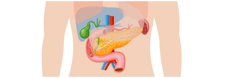 Bile Duct Obstruction