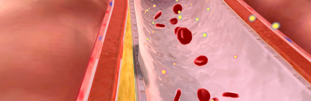 Hyperlipidemia