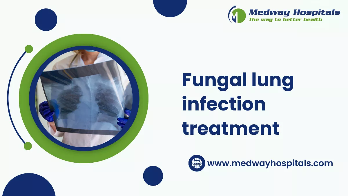 Fungal lung infection treatment | Medway Hospitals