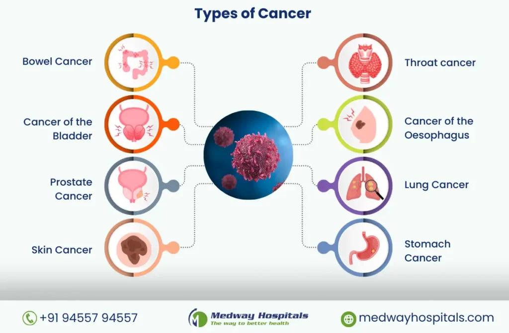 Oncologist in Chennai | Medway Hospitals