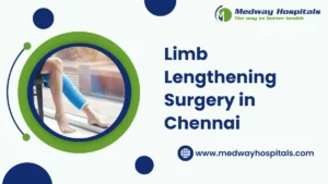 Limb Lengthening Surgery in Chennai