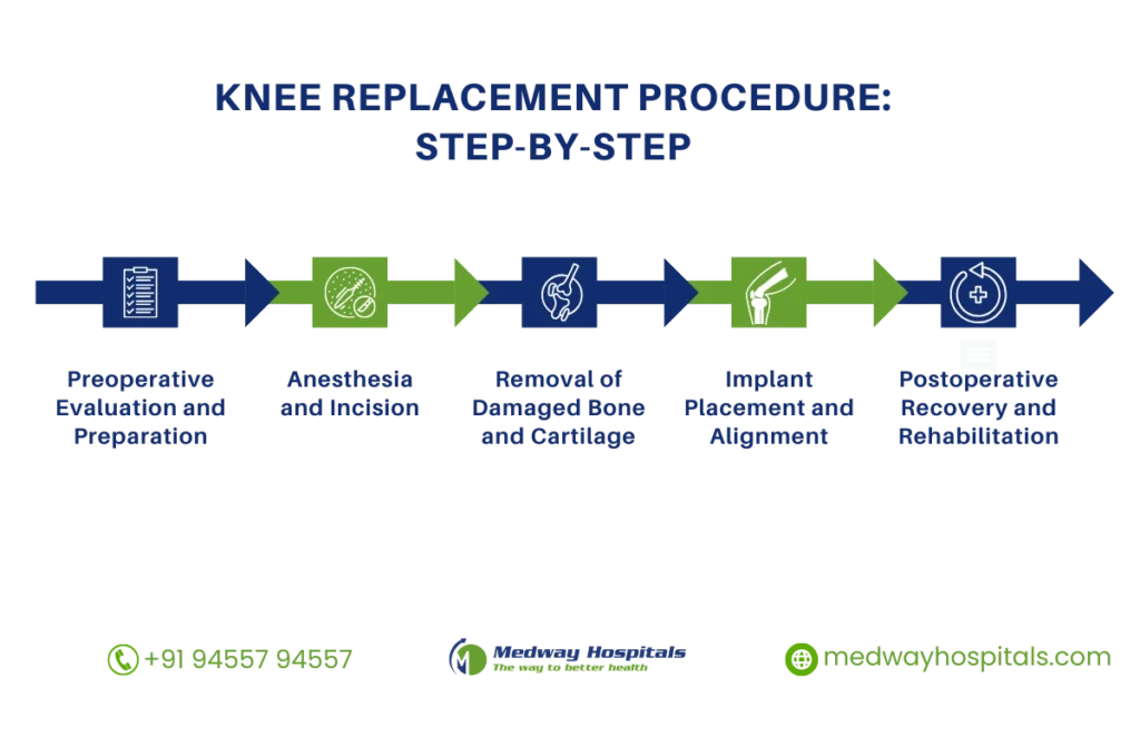 Best Knee Replacement Surgeon in India