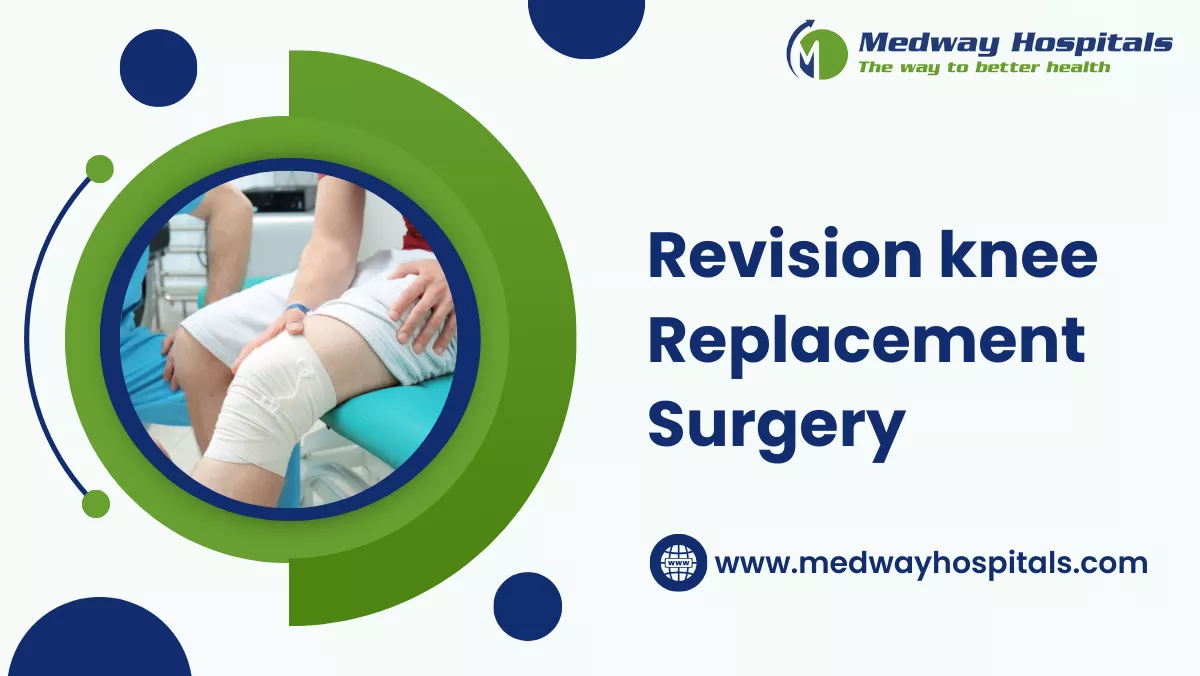 revision knee replacement surgery