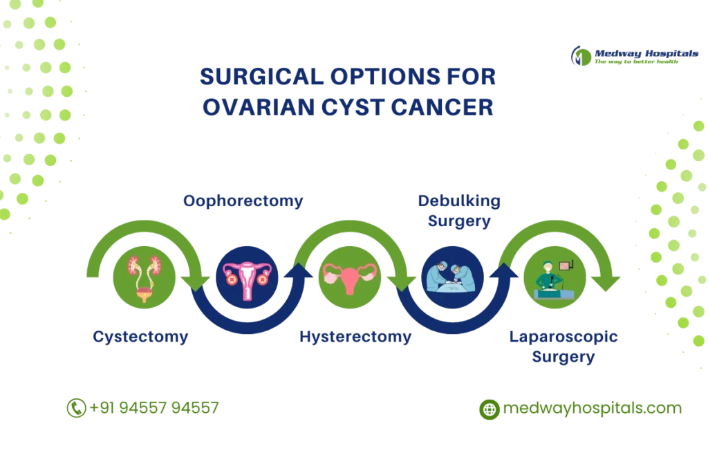 ovarian cyst cancer treatment