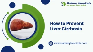 How to Prevent Liver Cirrhosis