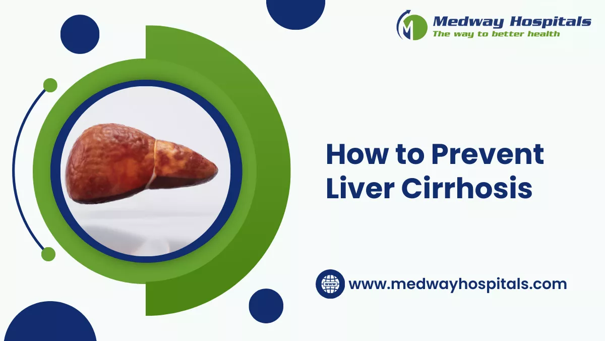 How to Prevent Liver Cirrhosis