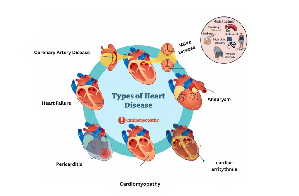 Cardiac Specialist in Chennai: