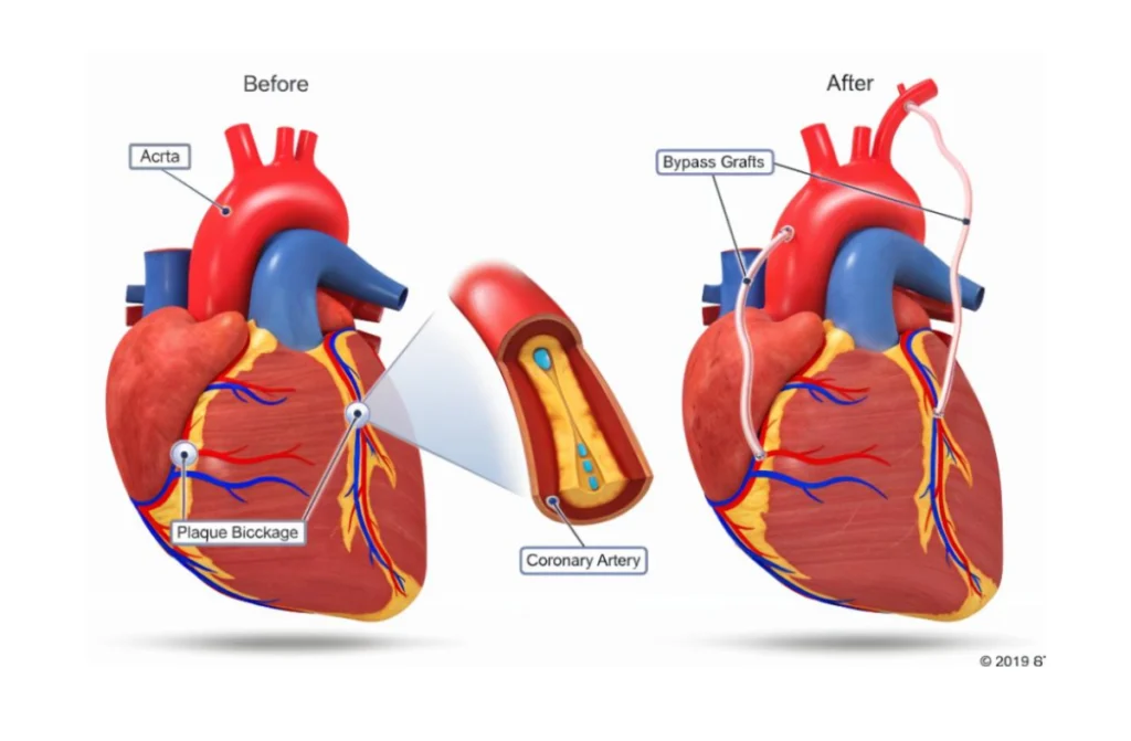 Cardiothoracic Surgeons in Chennai