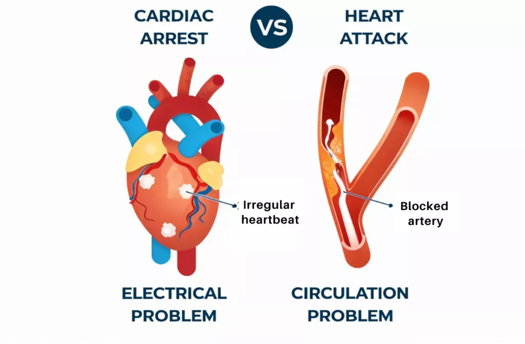 Sudden Cardiac Arrest