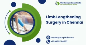 Limb Lengthening Surgery in Chennai