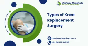 Types of Knee Replacement Surgery