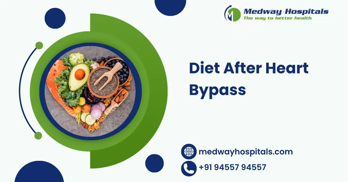 Diet After Heart Bypass