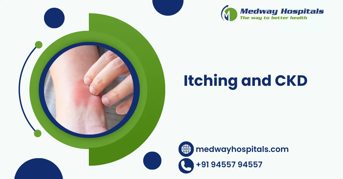Itching and Ckd