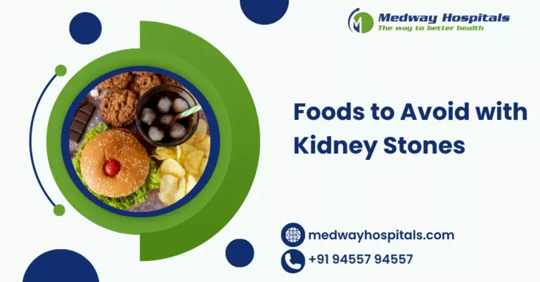 Foods to Avoid with Kidney Stones