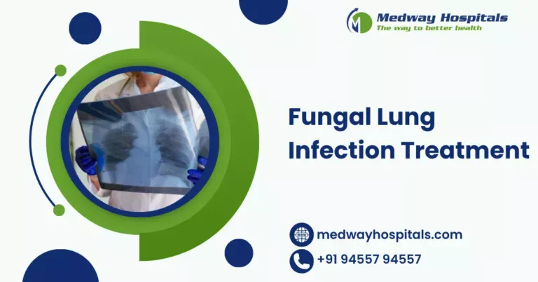 Fungal Lung Infection Treatment