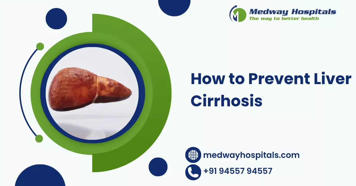 How to Prevent Liver Cirrhosis