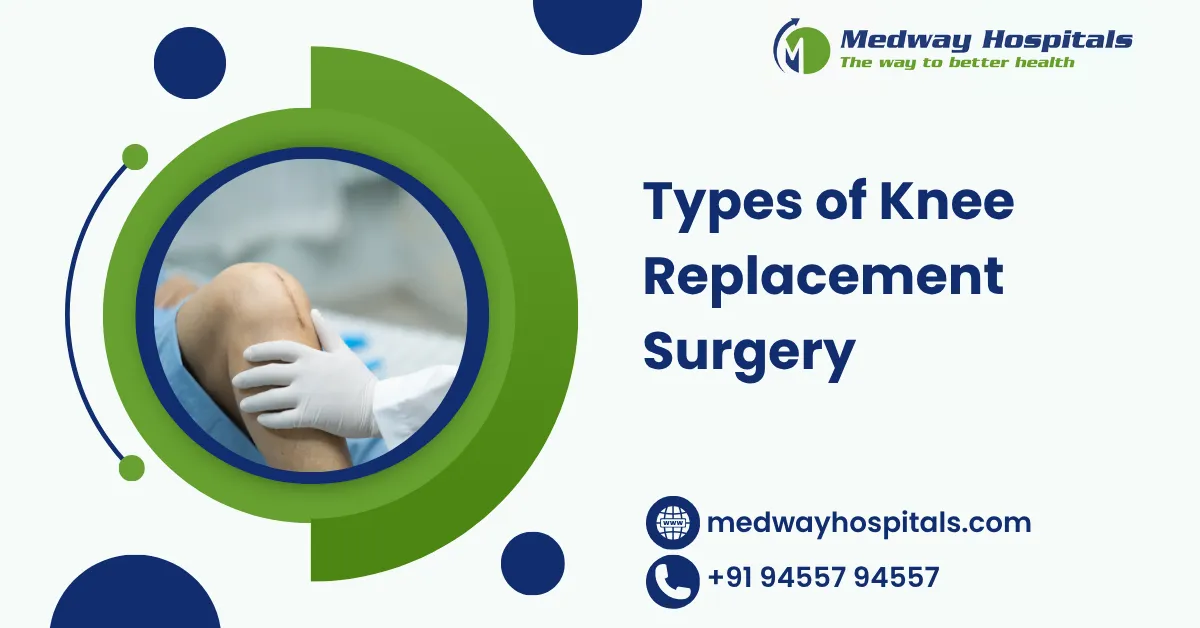Types of Knee Replacement Surgery