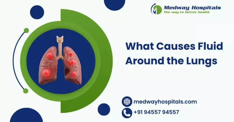 What Causes Fluid Around the Lungs