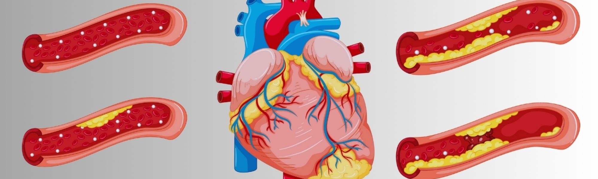 Congenital Heart Disease